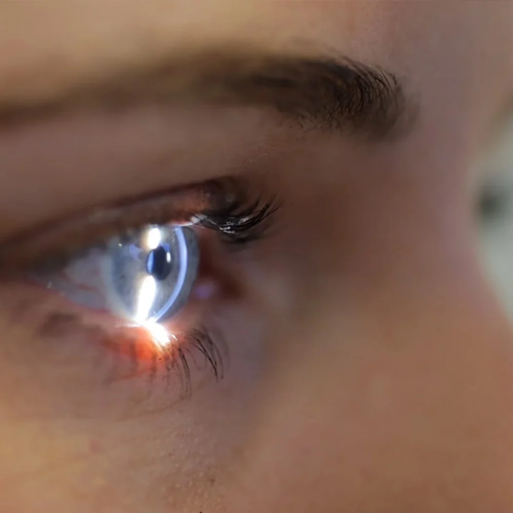 Recognizing the Symptoms of Keratoconus